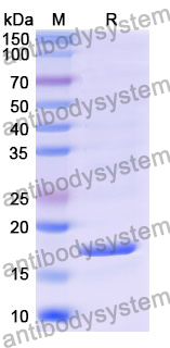 Recombinant Mouse CD134/TNFRSF4/OX40 Protein, N-His