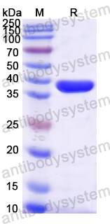 Recombinant Mouse XCL1/Lymphotactin Protein, N-GST & C-His