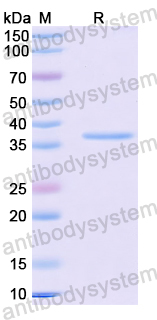 Recombinant Mouse CD295/LEPR Protein, N-His