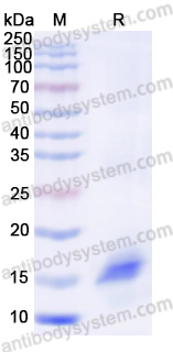Recombinant Mouse GIPR/GIP-R Protein, N-His