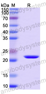 Recombinant Mouse CCN3 Protein, N-His-SUMO