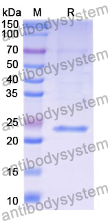 Recombinant Mouse COMP Protein, N-His