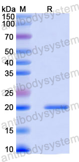 Recombinant Mouse Flt3 ligand/FLT3L Protein, N-His