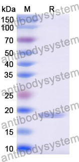 Recombinant Mouse SELENOP Protein, N-His
