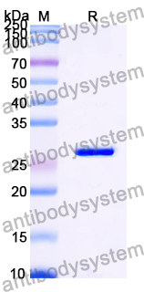 Recombinant Mouse RAB7A Protein, N-His