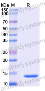 Recombinant Mouse EFNA4 Protein, N-His