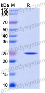 Recombinant Mouse CTSC Protein, N-His