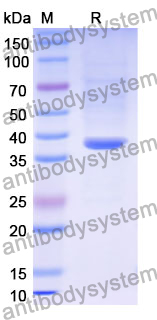 Recombinant Mouse GAS1 Protein, N-GST & C-His