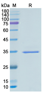 Recombinant Mouse VCP Protein, N-His