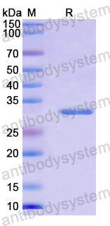 Recombinant Mouse FCGRT/FCRN Protein, N-His