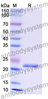 Recombinant Mouse BID Protein, N-His