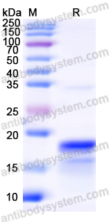 Recombinant Mouse LGALS4 Protein, N-His