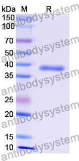 Recombinant Mouse OSTN Protein, N-GST & C-His