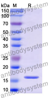 Recombinant Mouse OLR1/LOX1 Protein, N-His