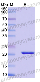 Recombinant Mouse LCN2 Protein, N-His