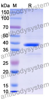 Recombinant Mouse CD83 Protein, N-GST & C-His