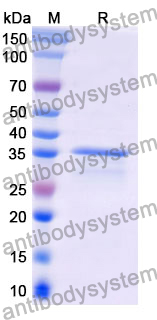 Recombinant Mouse CD125/IL5RA Protein, N-His