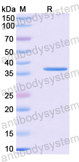Recombinant Mouse IL1RL1/ST2 Protein, N-His