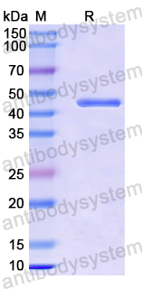 Recombinant Mouse CD202b/TEK/TIE-2 Protein, N-His