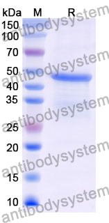 Recombinant Mouse CKAP4 Protein, N-GST & C-His