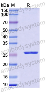 Recombinant Mouse CD69 Protein, N-His-SUMO