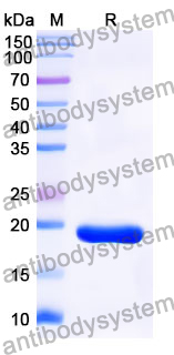 Recombinant Mouse FSTL1 Protein, N-His