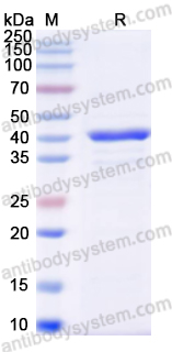Recombinant Mouse CHIT1 Protein, N-His