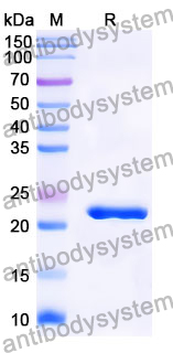 Recombinant Mouse PTK7/CCK-4 Protein, N-His