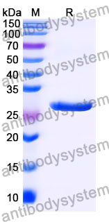 Recombinant Mouse MSLN/Mesothelin Protein, N-His