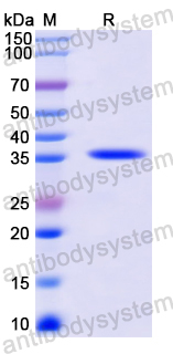 Recombinant Mouse CD218a/IL18R1 Protein, N-His