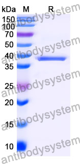 Recombinant Mouse GIT2 Protein, N-His