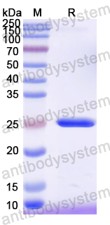 Recombinant Mouse IL27B/EBI3 Protein, N-His