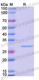 Recombinant Mouse FGL2 Protein, N-His