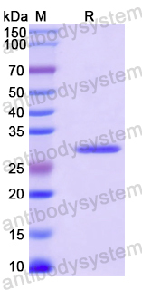 Recombinant Mouse LRRC32/GARP Protein, N-His