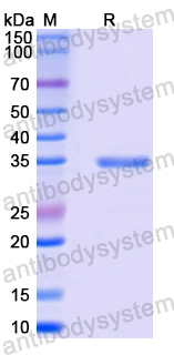 Recombinant Mouse CD213a2/IL13RA2 Protein, N-His