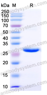 Recombinant Mouse RAGE/AGER Protein, N-His