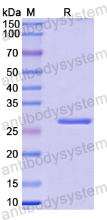 Recombinant Mouse CD226/DNAM-1 Protein, N-His