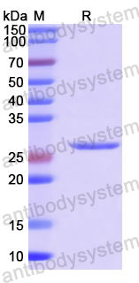 Recombinant Mouse Adiponectin/ACRP30/ADIPOQ Protein, C-His