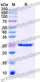 Recombinant Mouse ECM1 Protein, N-His