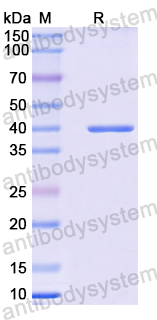 Recombinant Mouse TrkB /NTRK2 Protein, N-His