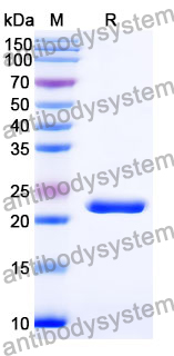 Recombinant Mouse CA9 Protein, N-His