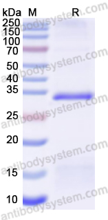 Recombinant Mouse UPP1 Protein, N-His