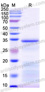 Recombinant Mouse SFRP5 Protein, N-His