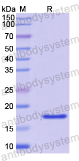 Recombinant Mouse IL31 Protein, N-His