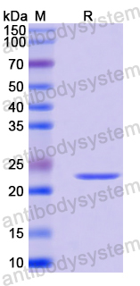 Recombinant Mouse SFRP4 Protein, N-His-SUMO