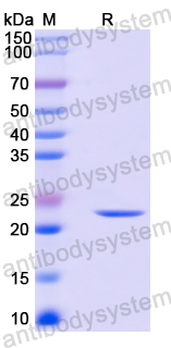 Recombinant Mouse CD305/LAIR1 Protein, N-His-SUMO