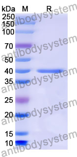 Recombinant Mouse SIGIRR Protein, N-GST & C-His