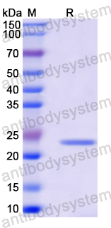 Recombinant Mouse CD200R1L Protein, N-His