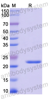 Recombinant Mouse IL27RA Protein, N-His