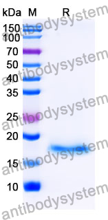 Recombinant Mouse NPNT Protein, N-His